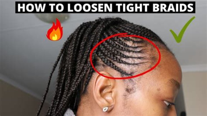 How do you loosen tight cornrows?