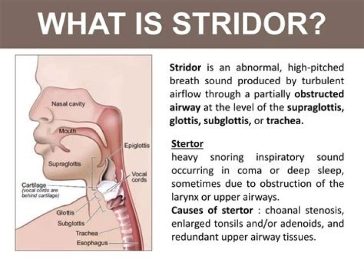 Is stridor an upper airway obstruction?