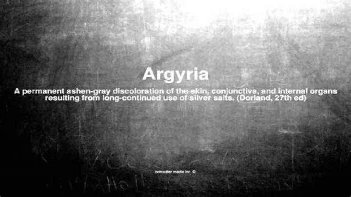What does Argyria mean?