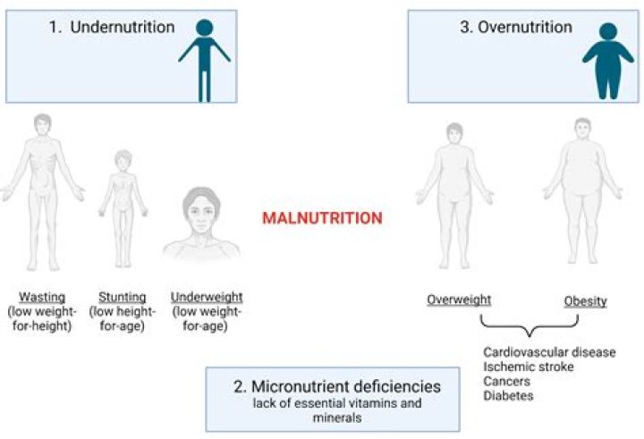 What is the difference between undernutrition malnutrition and overnutrition?