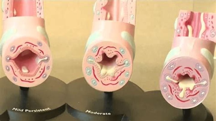 What is the Widow Douglas trying to do to Huck?